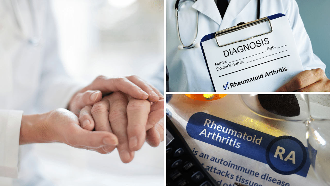 Rheumatoid Arthritis Explained: Diagnosis and Treatment (Revealed)