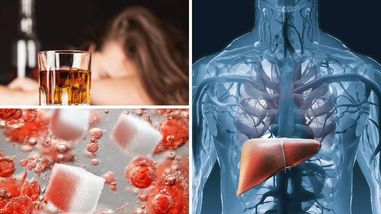 Alcohol vs. Sugar: Understanding Their Impact on Liver Health 🍸 or 🍩